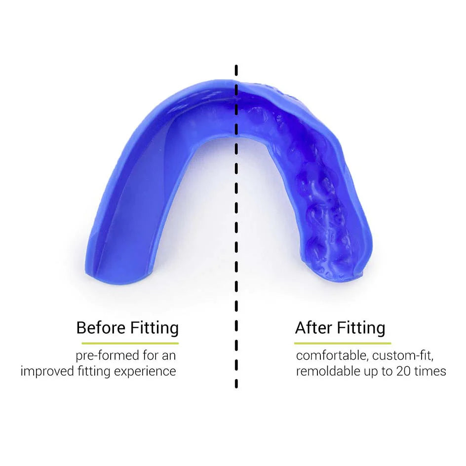 SISU 3D Mouth Guard