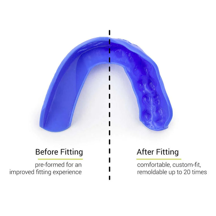 SISU 3D Mouth Guard